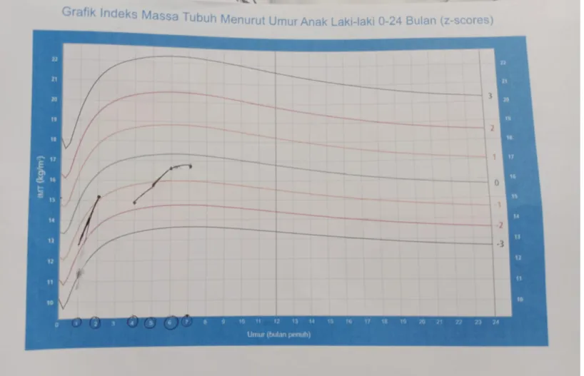 Grafik IMT menunjukkan garis berada di -2SD sampai dengan +1  SD ( gizi baik(Normal 