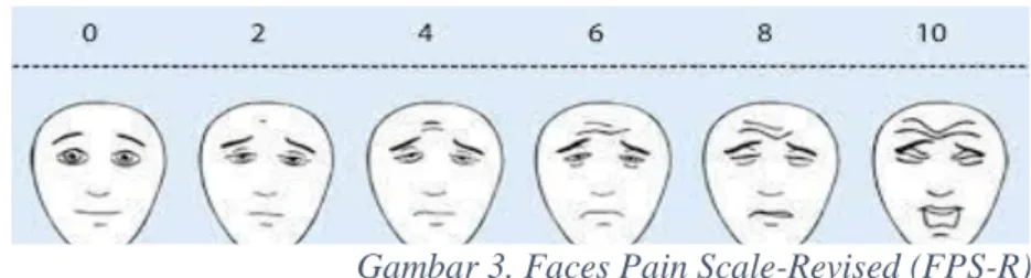 Gambar 3. Faces Pain Scale-Revised (FPS-R) 