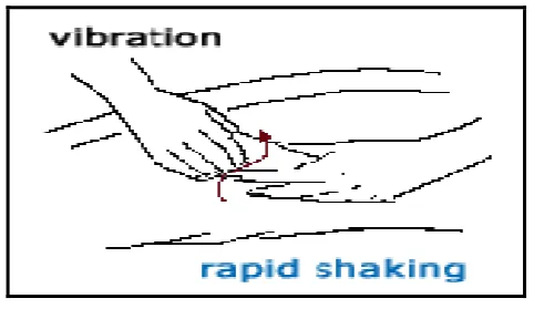 Gambar 5. Teknik Massage Vibration 