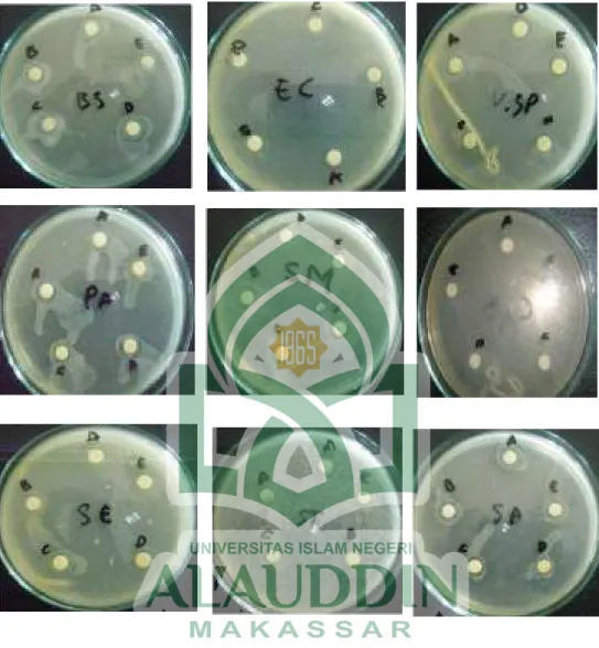 Gambar 4.  Foto  Hasil  Pengujian  Aktivitas  Antibiotik  Fermentat  Isolat  Bakteri  dan Jamur Terhadap Mikroba Uji             