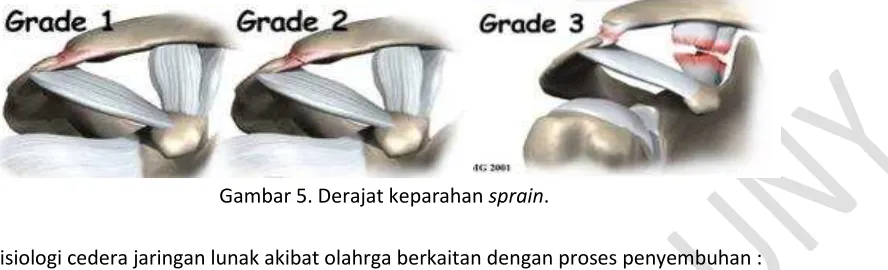 Gambar 5. Derajat keparahan sprain. 