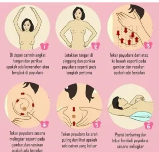 Gambar 3. Langkah-langkah SADARI