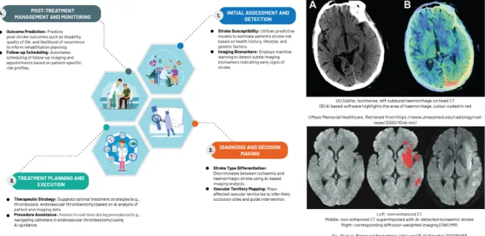 Figure 5. An overview of machine learning driven applications in neuroradiology [68,69].