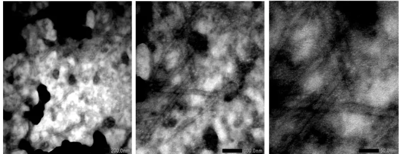 Fig. 3. Particle structure of ORSV with TEM observations; arrow indicates virus particles 