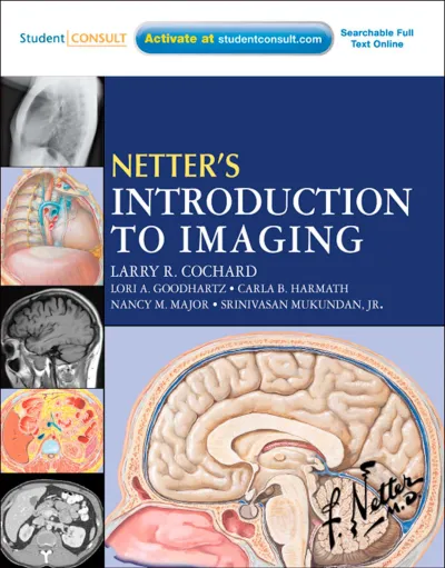 2 Back And Spinal Cord - Netter's Introduction To Imaging