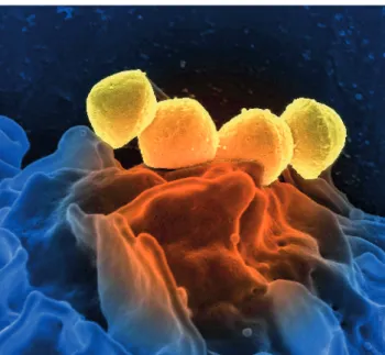 Gambar 1.1 Sel Streptococcus pyogenes (berwarna kuning) yang berada di   permukaan sel darah putih/neutrofil (berwarna biru)