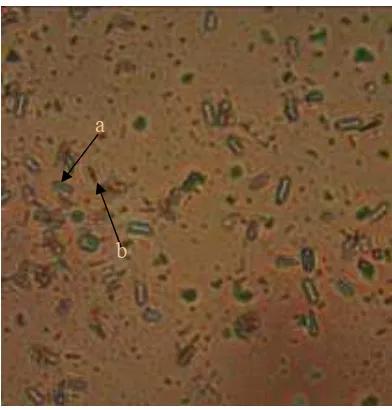 Gambar 4.3 Hasil pewarnaan spora ���������sp. BK17 (a) Endospora (b) Sel vegetatif 
