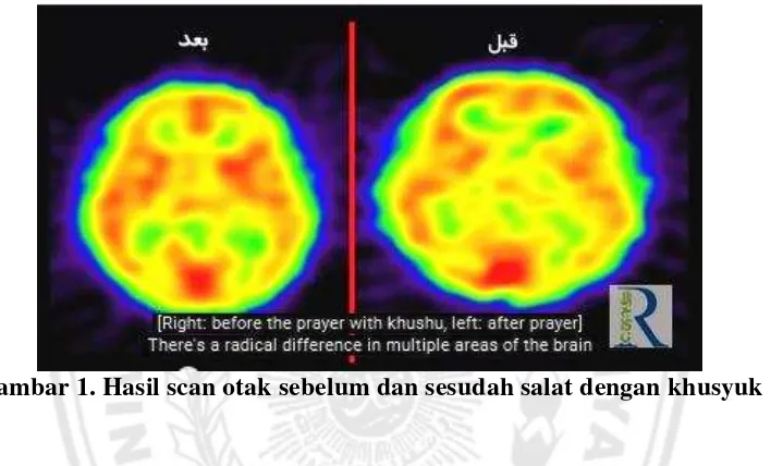 Gambar 1. Hasil scan otak sebelum dan sesudah salat dengan khusyuk 