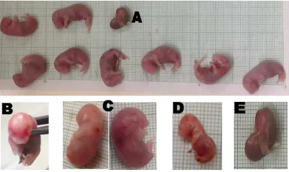 Figure 2  Fetuses of the second group. They have smaller size compared to control. And     there are fetuses that experienced intrauterine death, either dead fetus (A) or     resorbed fetus (B)