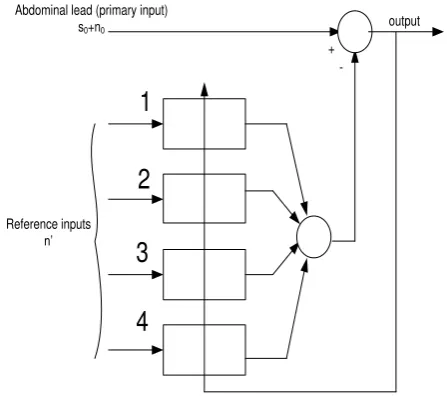 Gambar 1. Penghapusan Derau Multiple-Reference(Sumber:  Adaptive Signal Processing, BernardWidrow) 