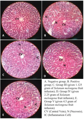 Figure 1 Histopathology of liver biopsy with 400x magnification