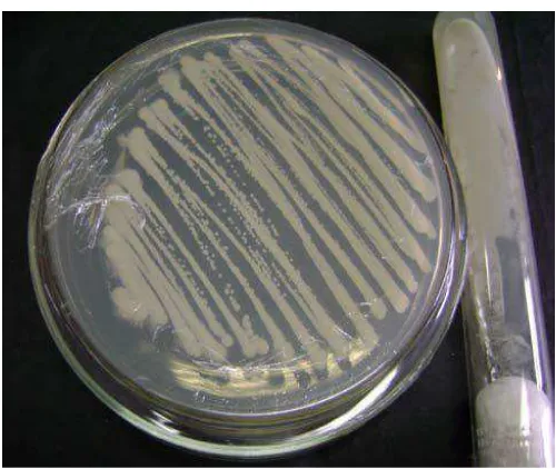 Gambar 2. Candida albicans pada media  Sabouraud’s dextrose agar 