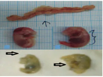 Figure 1 Fetus Resorption, Fetus with Cephalic and Whole Body Hemorrhage, and Fetus  