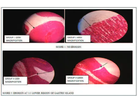 Figure 2 Microscopic Observation of Stomach Mucosal Erosion in Group III (Field mint     leaves Infusion) and Group IV (Misoprostol)