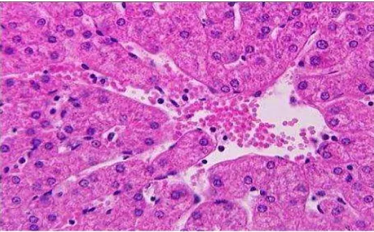 Figure 1 Liver Cells of CCl4-induced Mice