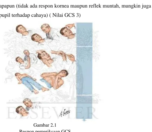 Gambar 2.1 Respon pemeriksaan GCS