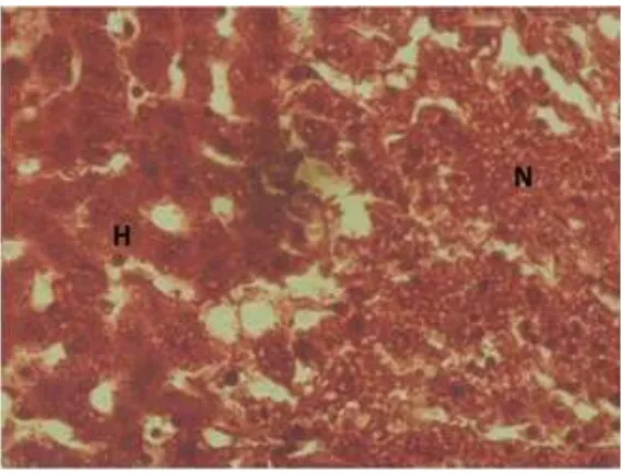 Figure 2 Liver Histologic View from Group II     Note: H=normal hepatocyte, N=necrotic area