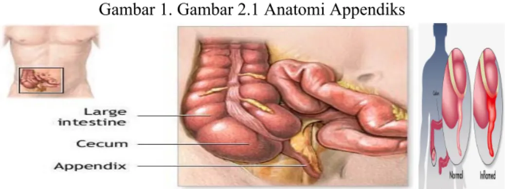 Gambar 1. Gambar 2.1 Anatomi Appendiks