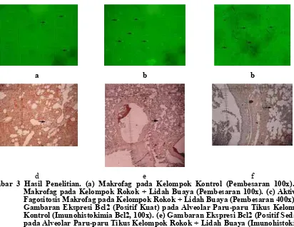 Gambar 3 Hasil Penelitian. (a) Makrofag pada Kelompok Kontrol (Pembesaran 100x). (b) Makrofag pada Kelompok Rokok + Lidah Buaya (Pembesaran 100x)
