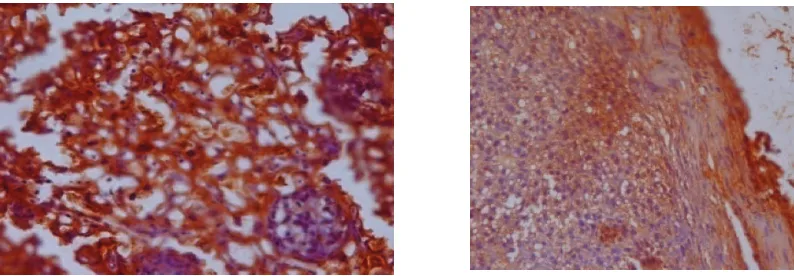 Gambar 2  Ekspresi Hsp-70 dengan Metode Imunohistokimia. Kiri: ekspresi Hsp-70 pada               kehamilan normal