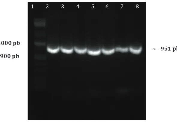 Gambar 1  Gambaran Elektroforesis Hasil PCR Regio c.-582A>G Promotor Gen   