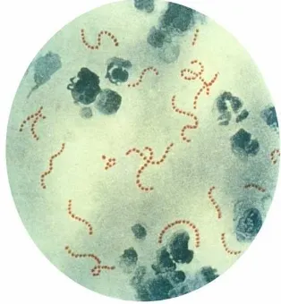 Gambar 1. Gambaran mikroskopis dari Streptococcus pyogenes