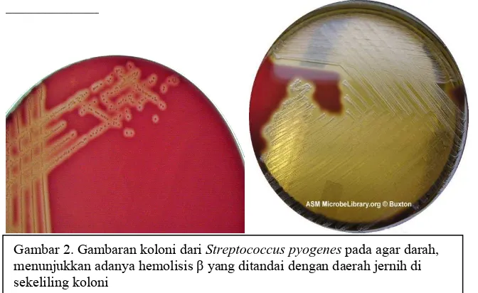Gambar 2. Gambaran koloni dari Streptococcus pyogenes menunjukkan adanya hemolisis pada agar darah, β yang ditandai dengan daerah jernih di 