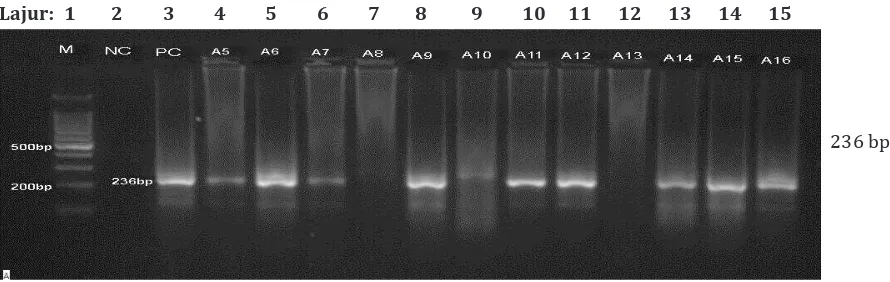 Tabel 2  Distribusi Hasil PCR dan Kultur pada    Pemeriksaan Sputum