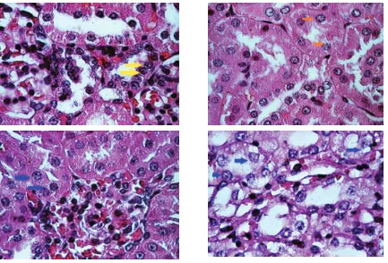 Gambar 2  Gambaran Histopatologi Tubulus Proksimal Ginjal pada Kelinci yang Diberi: (a) DKKP, (b)        DBKM