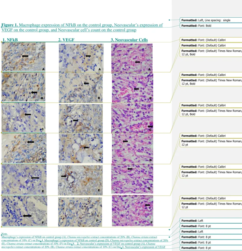 Figure 1. Macrophage expression of NFkB on the control group, Neovascular’s expression of  VEGF on the control group, and Neovascular cell’s count on the control group 