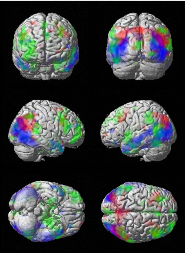 Figure 14  Surface projections of color-coded statistical parametric maps (SPMs) the results of a two-way  ANOVA (p<0.005, uncorrected) overlaid onto canonical single-subject anatomic rendering