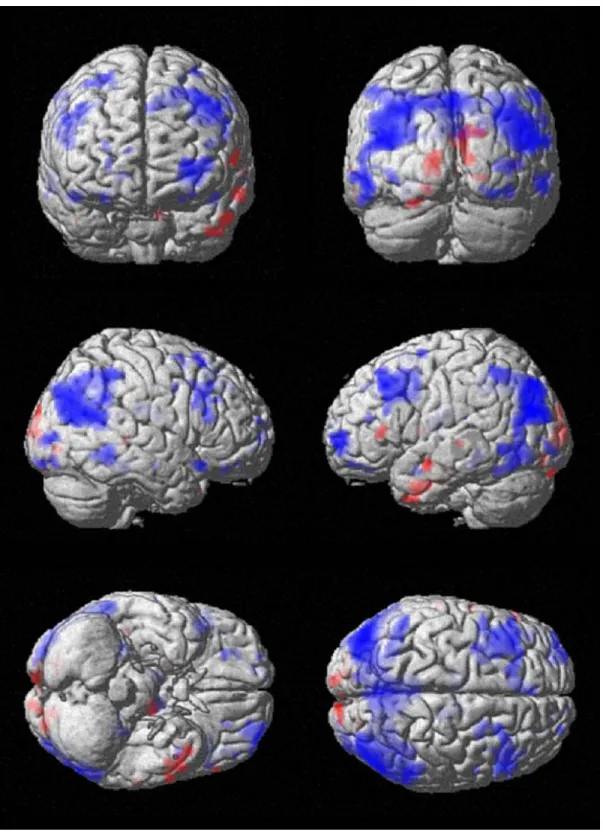 Figure 15  Surface projections of color coded statistical parametric maps (SPMs) showing the  results of second-level t-tests (p<0.005, uncorrected) overlaid onto canonical single subject  anatomic rendering