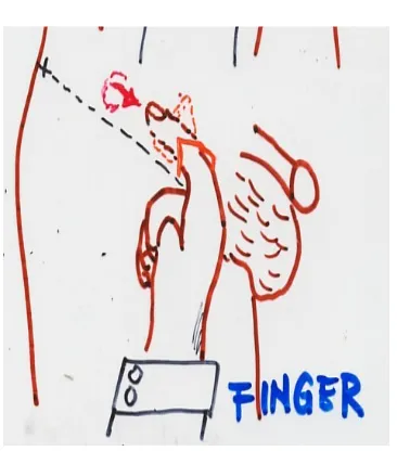 Gambar 7. Finger Test