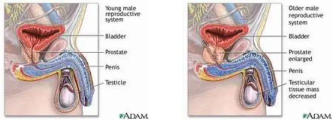 Gambar 3.Perbedaan sistem reproduksi pria muda dan pria lanjut usia