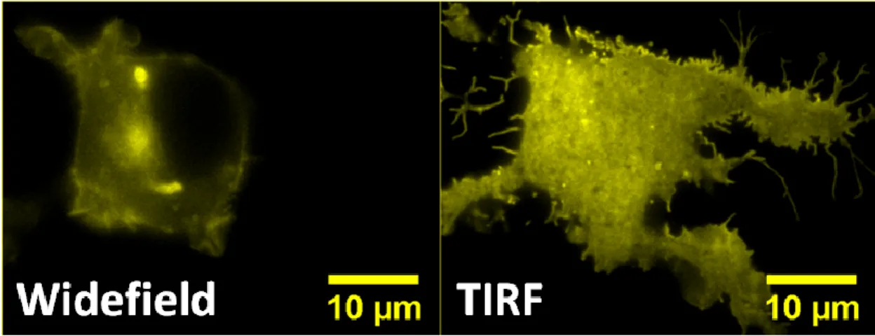Figure 7 displays a cell illuminated such that the laser illuminates the entire sample  (widefield fluorescence), and the same cell illuminated by a laser that is introduced at the  TIR critical angle (TIRF)
