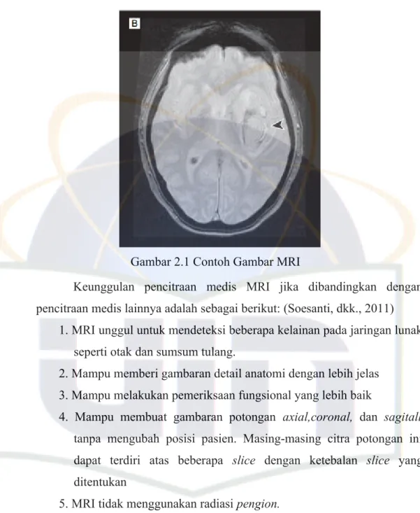 Gambar 2.1 Contoh Gambar MRI