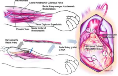 Gambar 6 Arteri Radialis