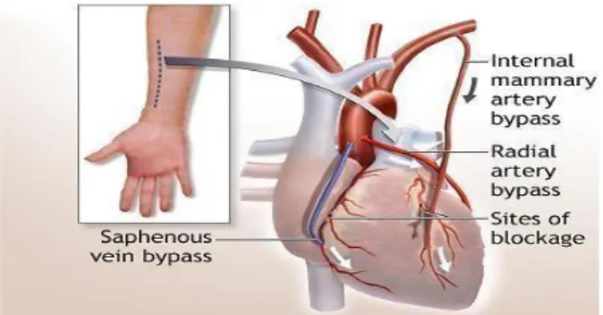Gambar 3. Arteri Radialis 