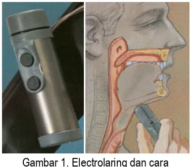 Gambar 1. Electrolaring dan cara 