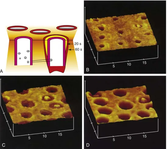 FIG. 2.8 Stages of dentin demineralization. (A) Schematic showing progressive stages of dentin demineralization