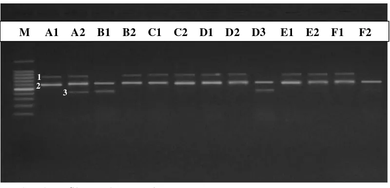 Gambar 4. Profil PCR dengan primer OPH-06 