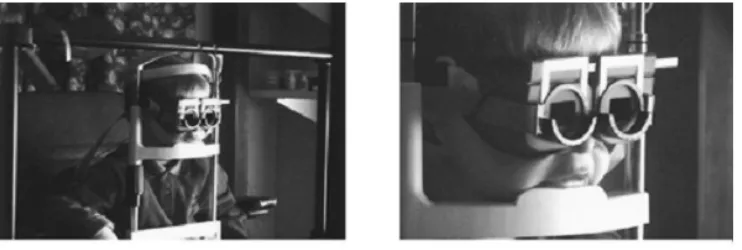 Gambar 9. Pemeriksaan infrared reflectance oculography. 1