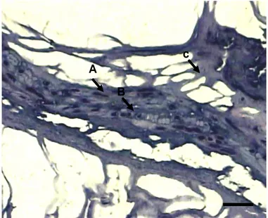 Gambar 4    Gambaran  mikroskopik  jaringan  ikat  fibrous  pada  sampel  bakso.    (GCAH,  skala = 2 m)