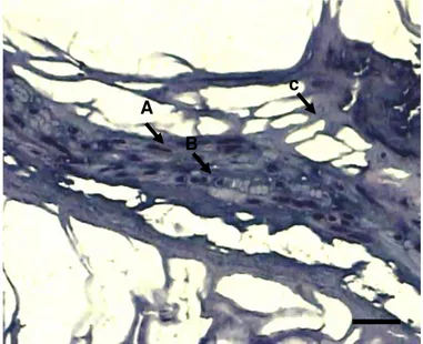 Gambar 4    Gambaran  mikroskopik  jaringan  ikat  fibrous  pada  sampel  bakso.    (GCAH,  skala = 2 Pm)