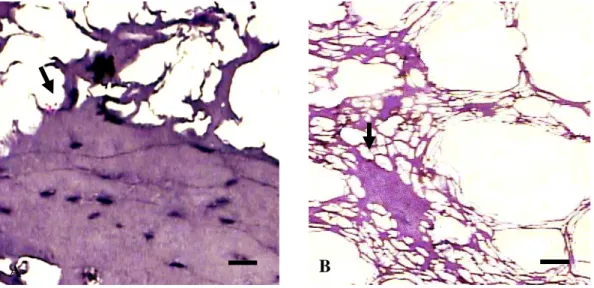 Gambar 7    Gambaran  mikroskopik  serabut  otot  yang  hancur  pada  sampel  bakso.    Jenis  otot masih dapat teridentifikasi (A), jenis otot tidak dapat terindentifikasi (B),  tanda panah menunjukkan kerusakan yang terjadi