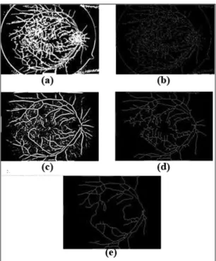 Gambar 3 merupakan hasil dari keseluruhan proses kombinasi dua metode yang telah dilakukan dengan menggunakan kombinasi metode MSLD dan Adaptive Morphology