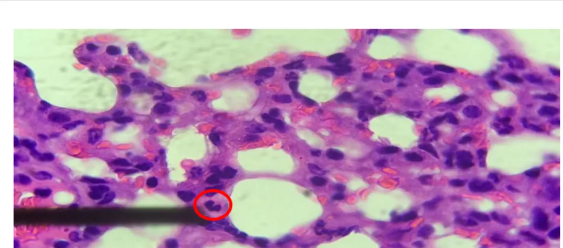 Tabel 2. Uji Post hoc Bonferroni  Data  Jumlah Eosinofil pada Paru 