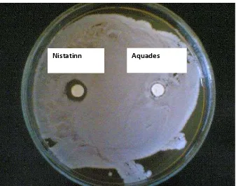 Gambar 2. Zona Hambat Antibiotik Nistatin pada Konsentrasi 0,4 mg
