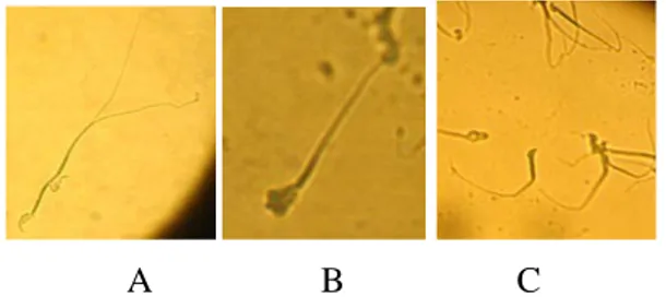 Gambar 2.  Spermatozoa mencit yang  abnormal; spermatozoa dengan 2 kepala dan 2  ekor (A), spermatozoa dengan kepala abnormal  (B), spermatozoa dengan badan dan ekor  melipat (C)