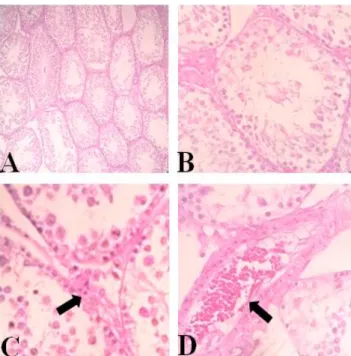 Gambar 1. Gambaran mikroskopis testis kelompok 1: (A) perbesaran 100x, (B) perbesaran 